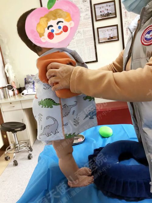 儿童康复：发育迟缓脑瘫康复