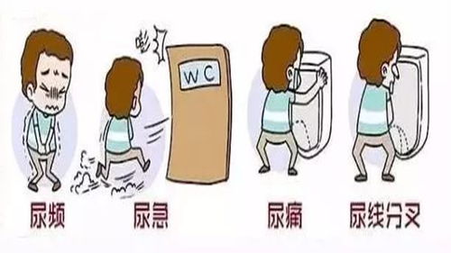 尿急憋不住尿，是膀胱过度活动症吗