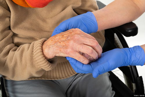 帕金森病有什么早期症状