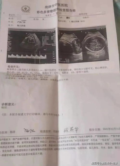 中国第一个试管婴儿