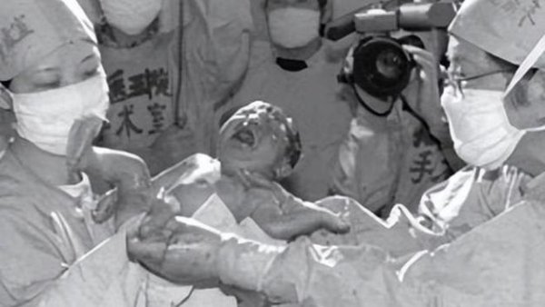 中国,第一个,试管婴儿