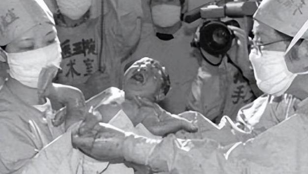 中国第一个试管婴儿