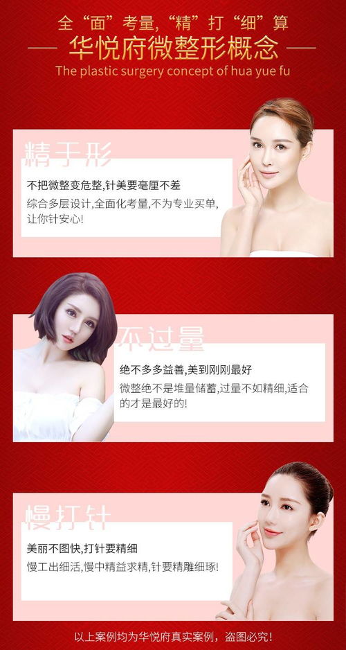 下巴,整形,手术,方式,假体