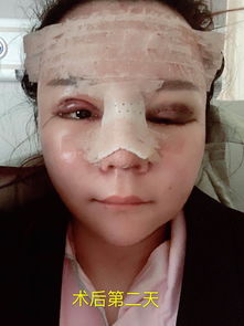 上海微整形哪里好？上海微整形与注射美容医院排名及推荐