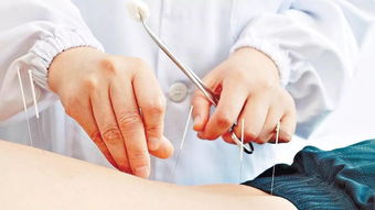 减肥埋线对身体有害吗，中医埋线的原理和潜在风险