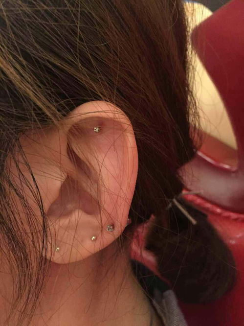 做耳垂整形多少钱？做耳垂整形价格与耳垂修复、耳洞修复费用