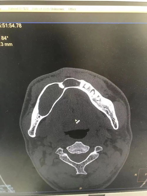 整形,医院,医美,哪家,公立