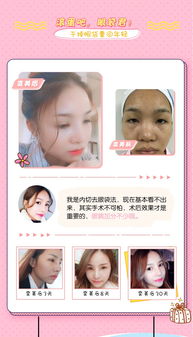 外科,整形,包含,哪些,项目