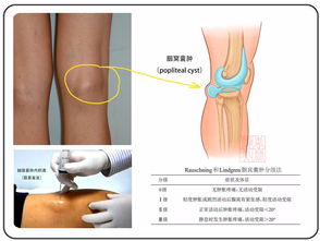 关节肿胀：关节肿了，查原因