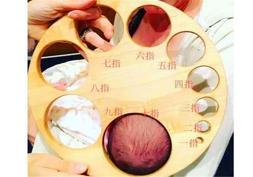 会阴侧切多久能愈合拆线疼不疼