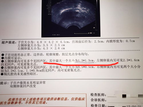 人工流产最佳时间是什么时候孕6-8周还是10周前
