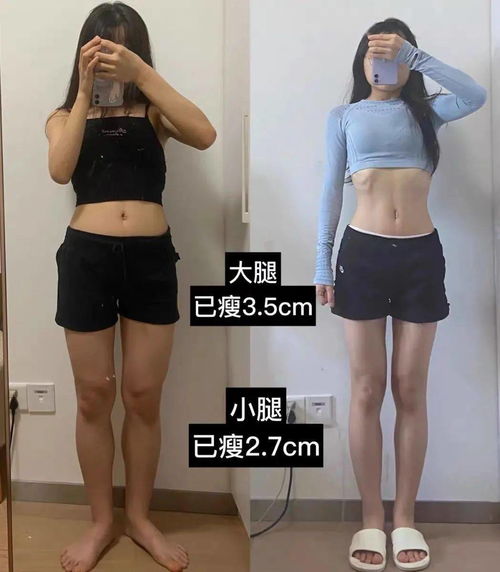 减肥针一针大概瘦多少斤，打过的人真实反馈来了