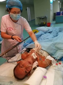 尿潴留-尿不出来当上火，急诊科导尿后查出前列腺重度增生