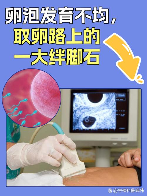 人工受孕和试管婴儿哪个好？卵泡多大取卵