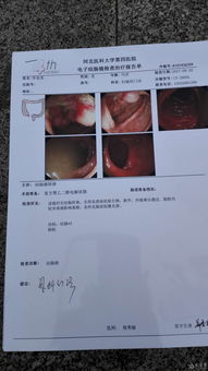 白斑,癌前,病变