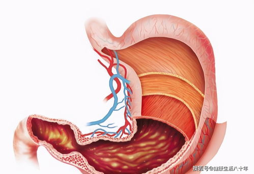 克罗恩病的人,这些食物会诱发发作 克罗恩病的人,这些食物会诱发发作