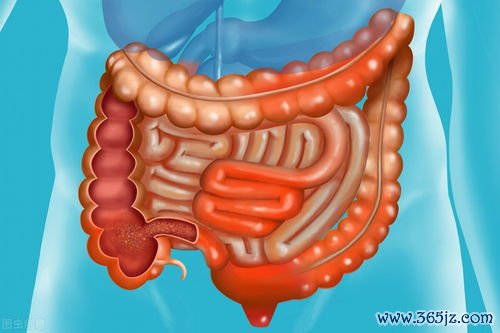 肝囊肿需要治疗吗？多大要处理