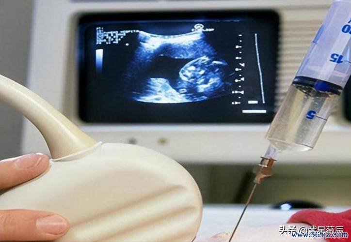 什么情况下试管婴儿