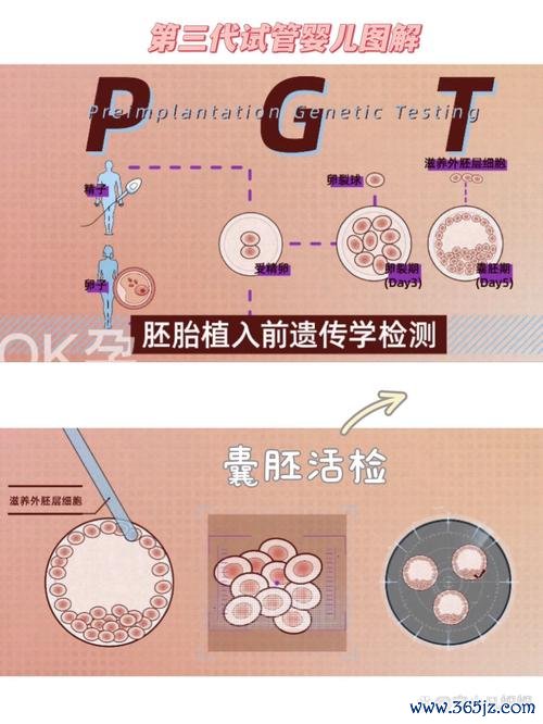 什么是三代试管婴儿