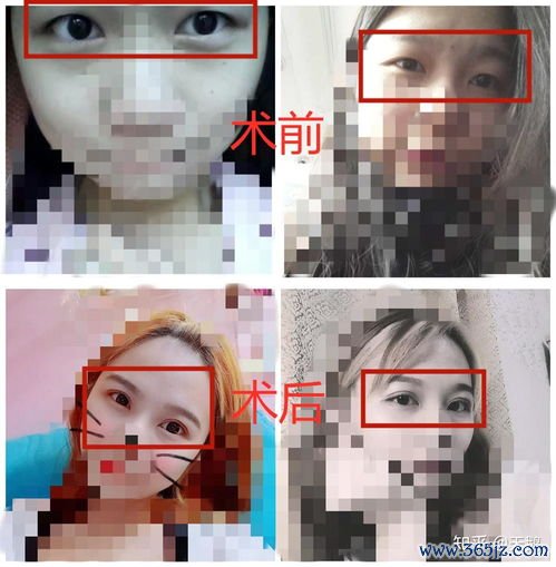 广州整形医院哪家好？广州整形医院与南方医院整形科对比