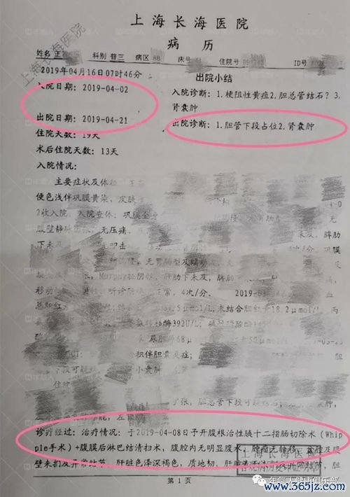 肾囊肿会癌变吗？怎么随访