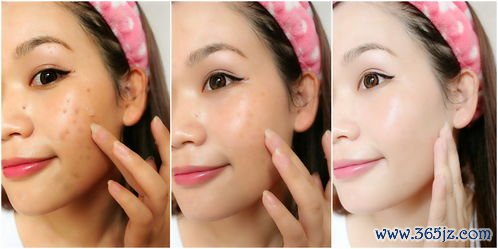 脸上,长痘,嘴里,口气,这是