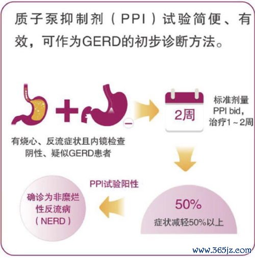 胃食管反流烧心反酸，怎么缓解