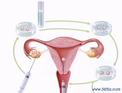 供卵试管婴儿医院