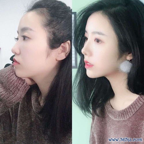 整形,整容,医院,怎么,医疗美容