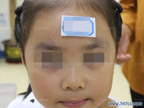 整形,美容,皮肤科,区别,治疗