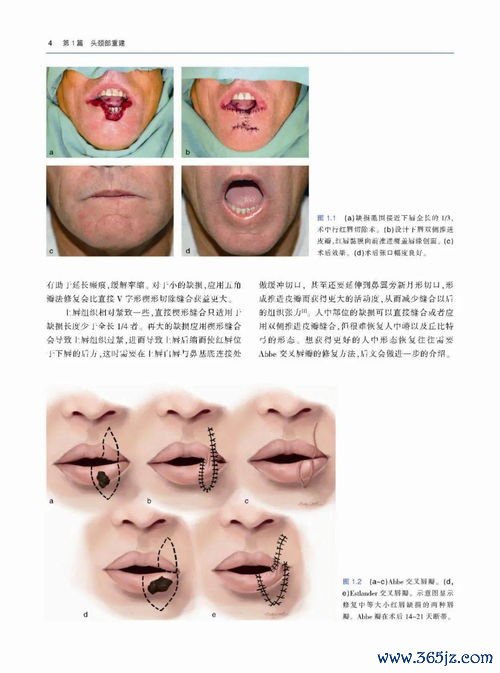 整形手术类型：整形与私密整形手术的种类及术后护理
