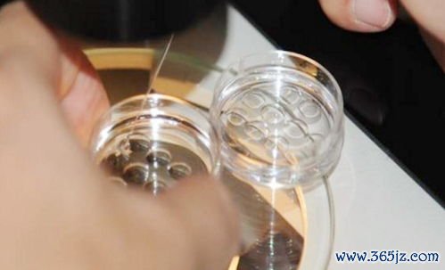 做一个试管婴儿费用