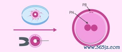 做一次试管婴儿多钱