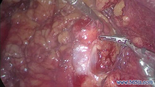 卵子冷冻能保存多久取卵手术疼吗