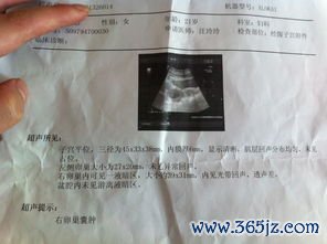 卵巢囊肿会自己消失吗