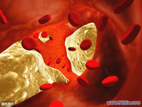 坏胆固醇太高血管要堵，这些食物要拉黑