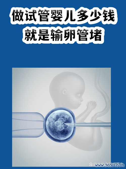 做次试管婴儿多少钱