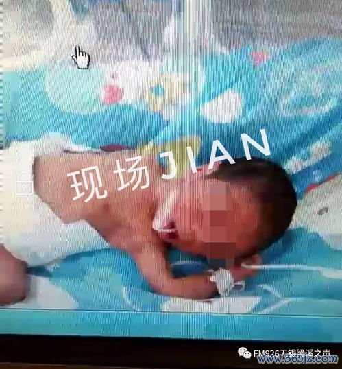 做双胞胎试管婴儿多少钱