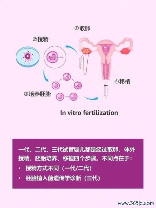 做试管婴儿三代，二代智商