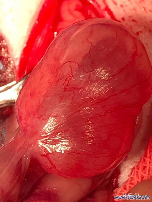 卵巢囊肿剥除术后会复发吗影响卵泡发育吗