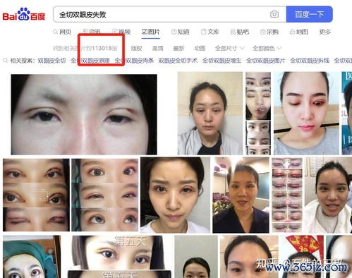 整形美容,项目有,哪些,皮肤,美容