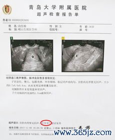 做试管婴儿会宫外孕吗