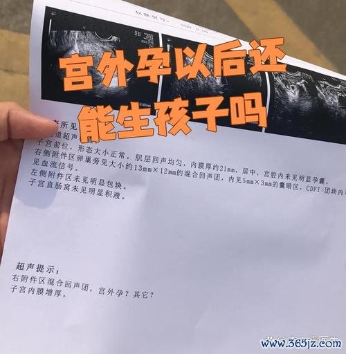 做试管婴儿会宫外孕吗