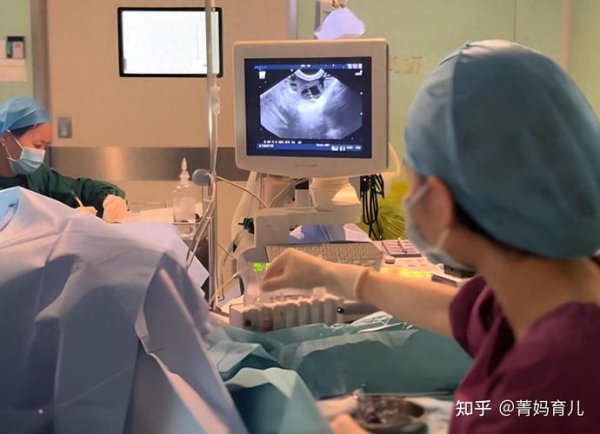 试管婴儿,全过程