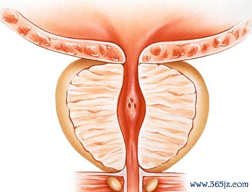 前列腺保健的方法：前列腺保健与男性泌尿系统健康管理日常注意事项