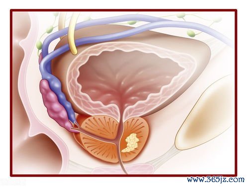 前列腺保健的方法：前列腺保健与男性泌尿系统健康管理日常注意事项
