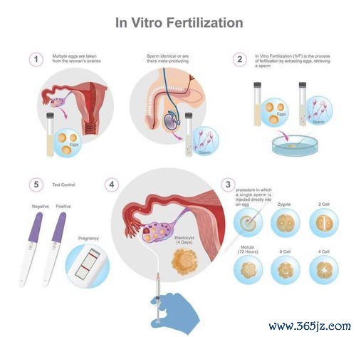 做试管婴儿具体流程