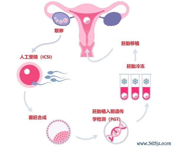 做试管婴儿全部过程，试管婴儿有哪些技术