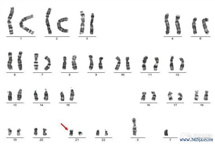 做试管婴儿前染色体