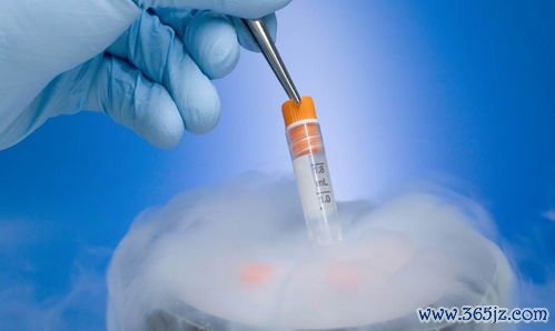 做试管婴儿前的准备